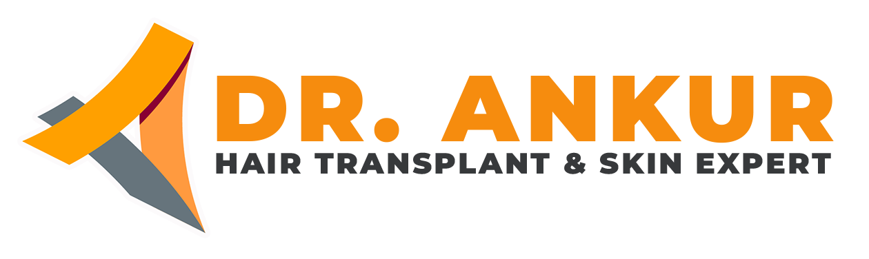 Doctor Ankur – Dr. Ankur Bhardwajl is a Hair Transplant Expert in Gwalior.